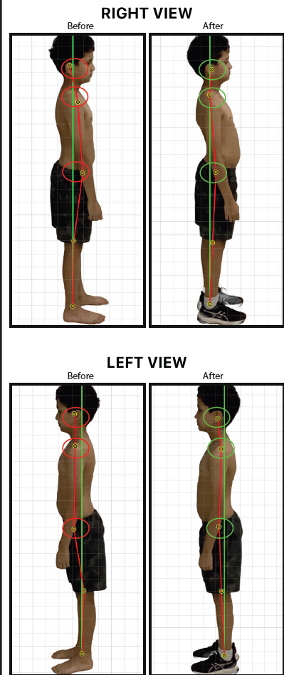 Posture Scan Visual Report