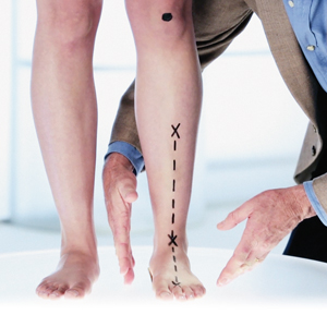 Clinical Biomechanics